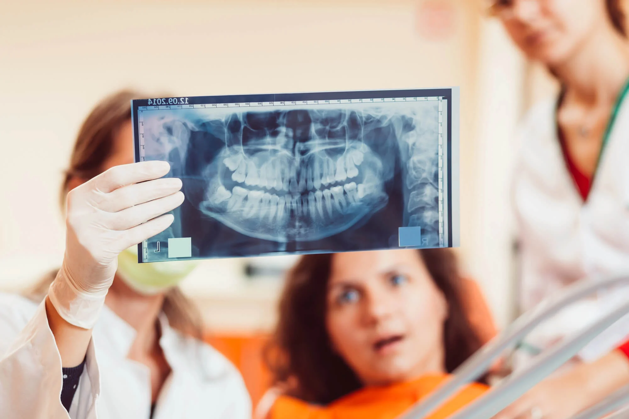 dentist showing an X-ray image before Wisdom Teeth Removal in Boca Raton