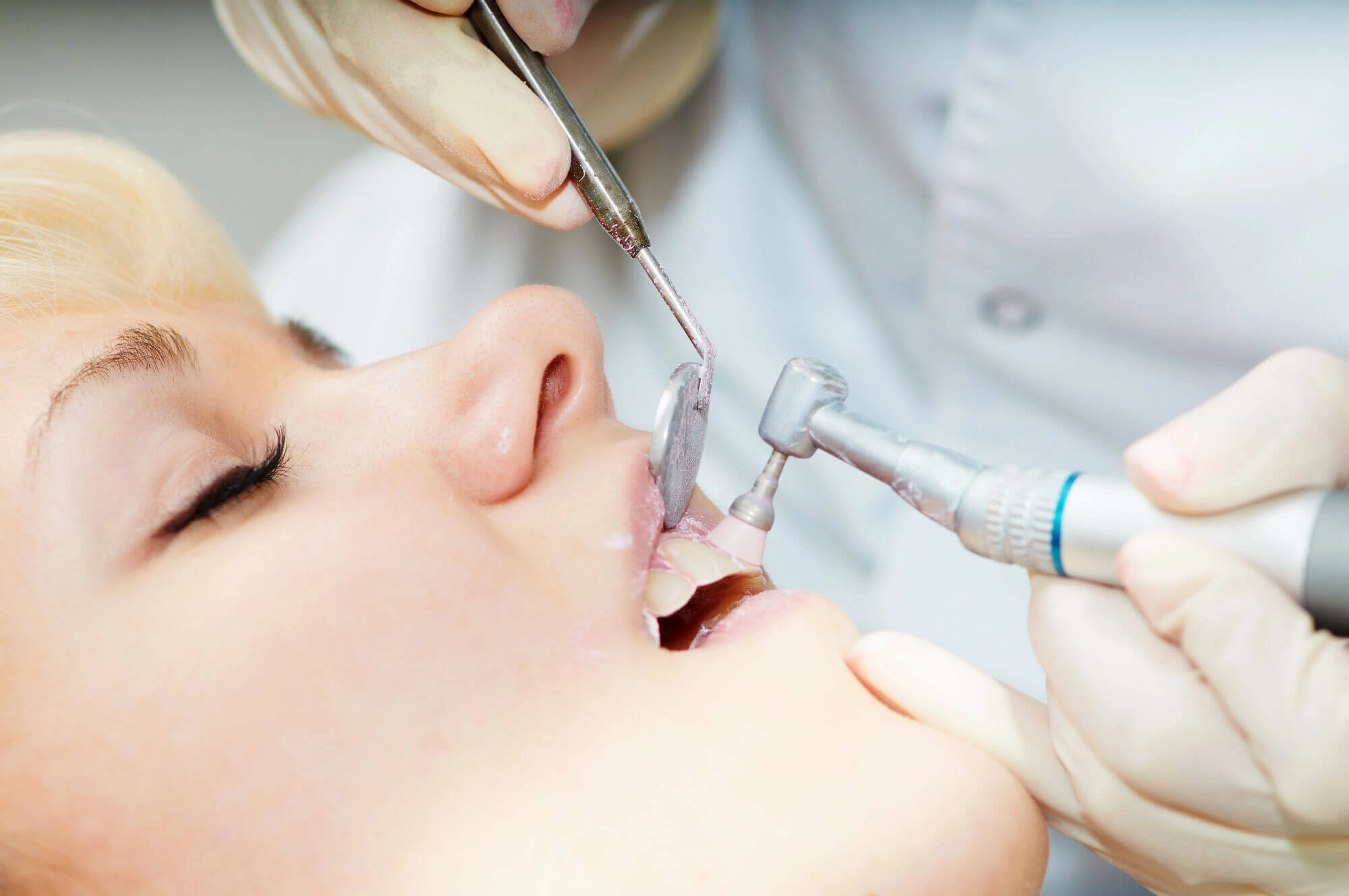 Dental Cleaning in Boca Raton