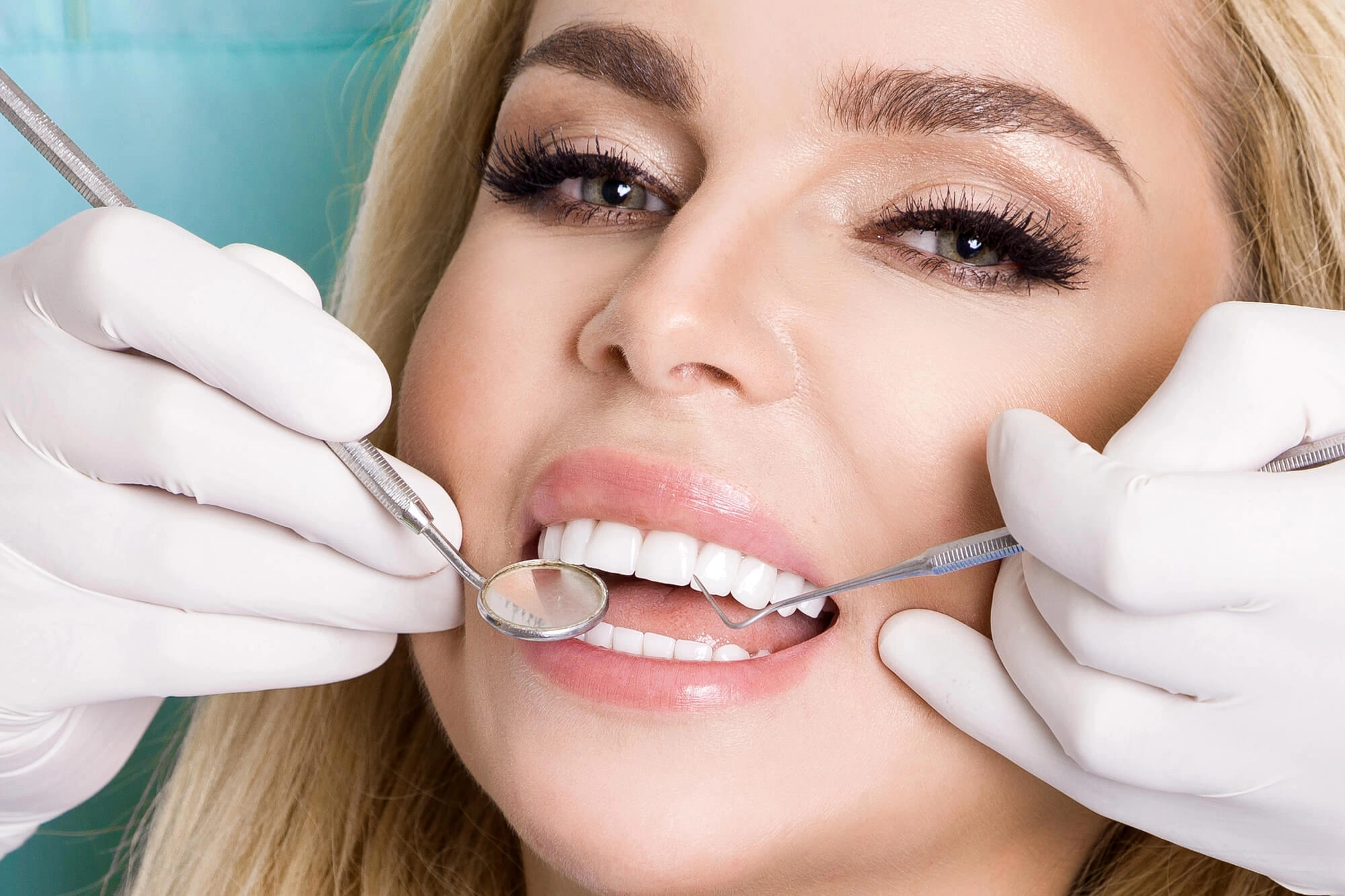 Smiling with veneers boca raton