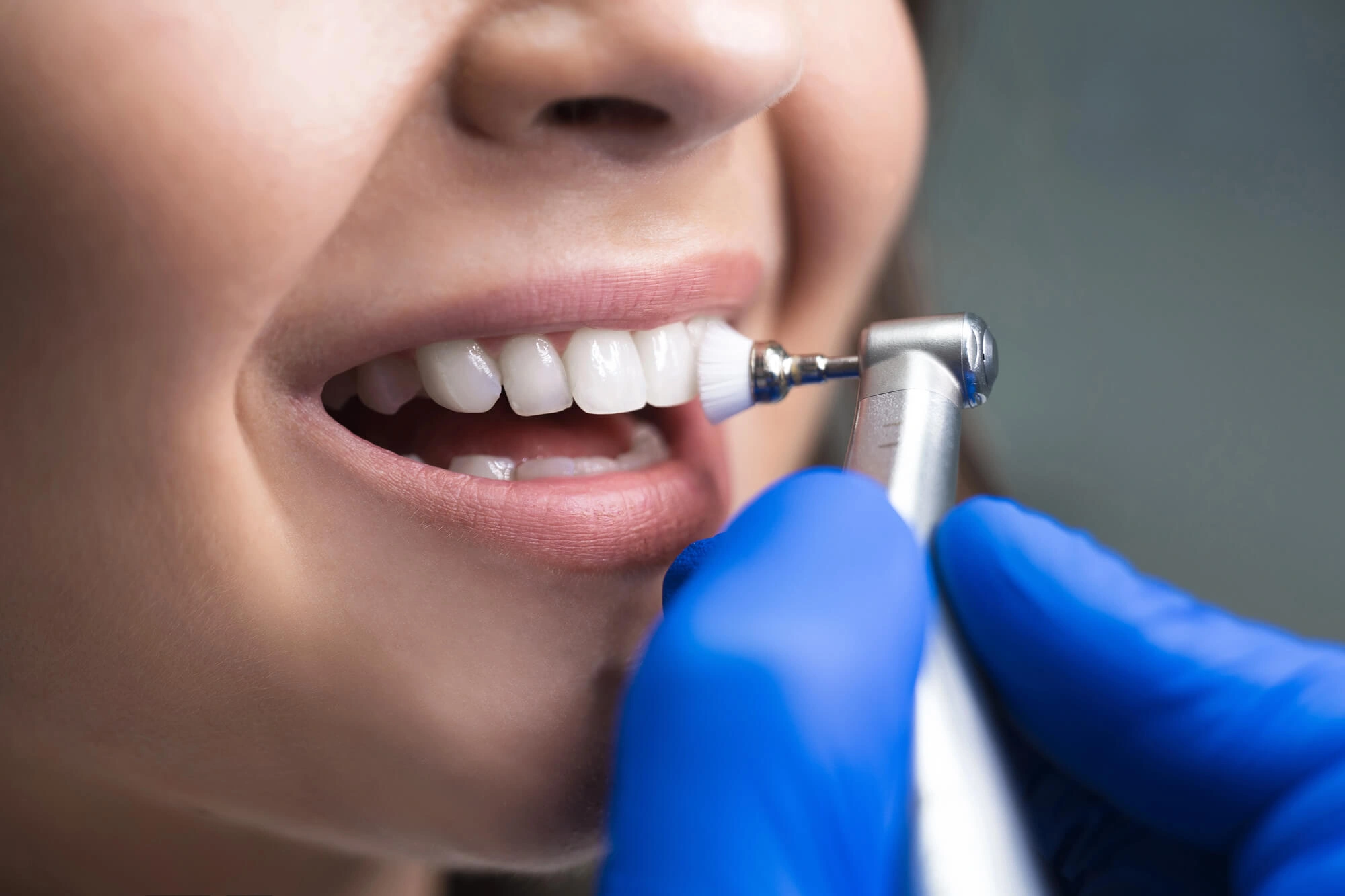 Woman undergoing dental cleaning boca raton